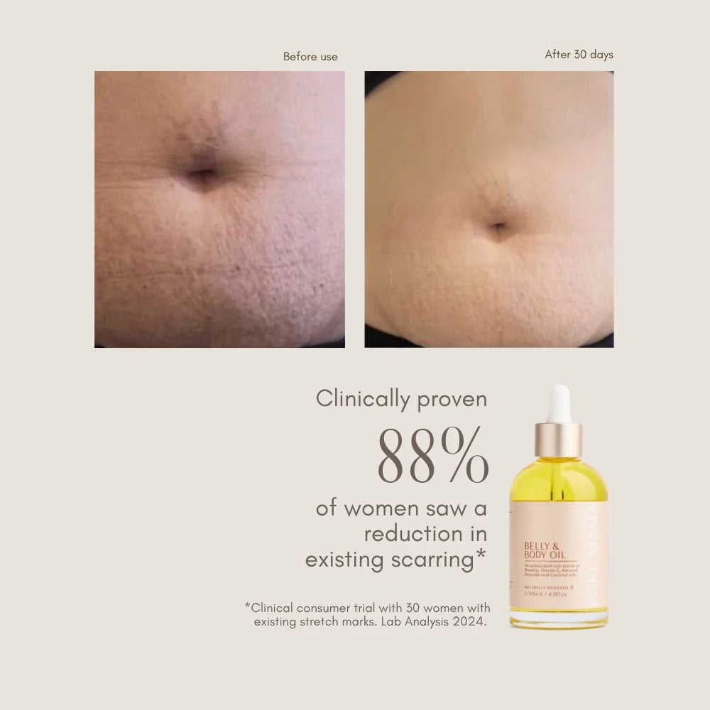 Pure Mama Bump Love Set featuring belly and body oils, and a body scrub designed for women caring for stretch marks and skin.