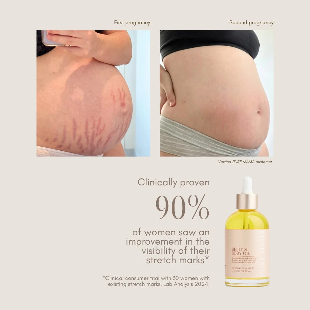 Pure Mama Bump Love Set for women featuring stretch mark belly oil, cream, and lotion in a 145ml bottle, for skin firming.