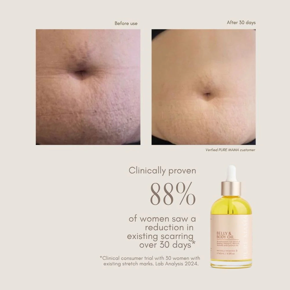 Pure Mama Belly & Body Oil for women, showing a 145ml bottle of stretch mark and firming oil with natural ingredients.
